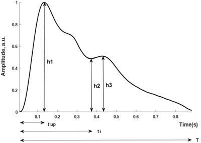 Quantitative Comparison of the Performance of Piezoresistive, Piezoelectric, Acceleration, and Optical Pulse Wave Sensors